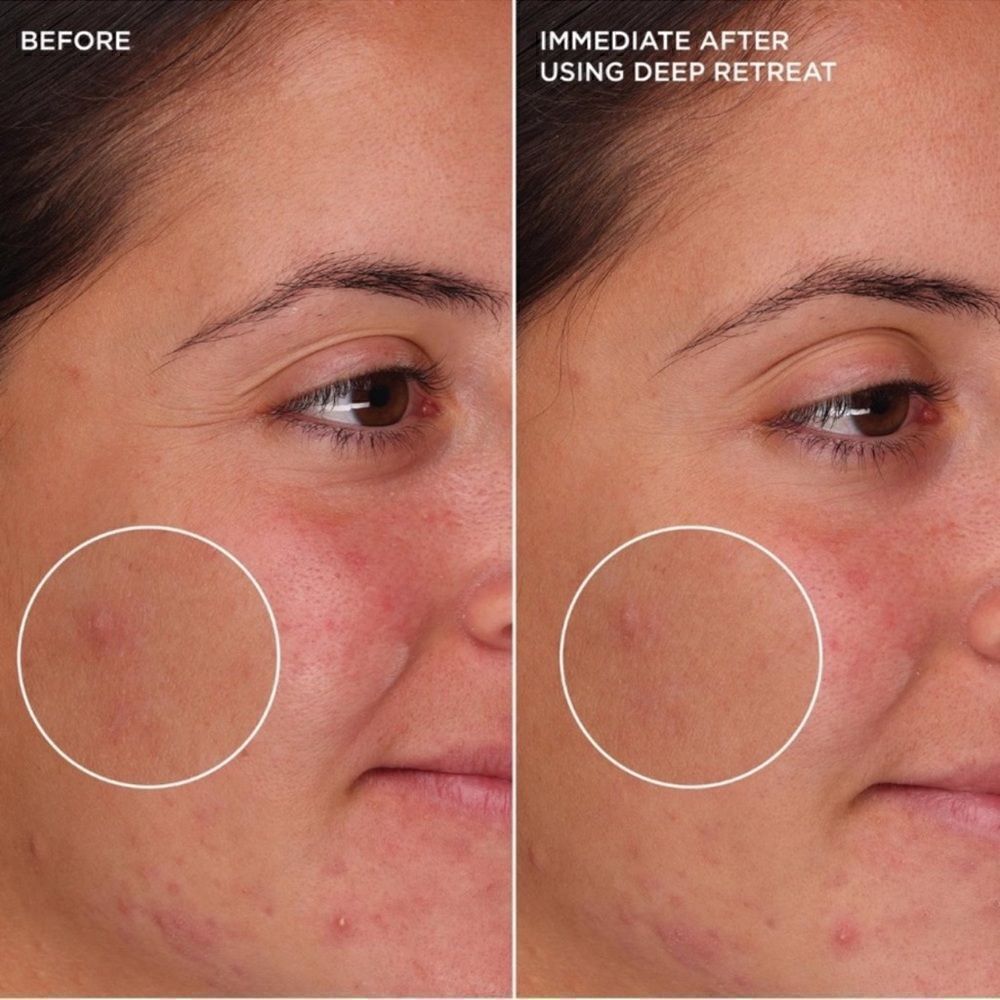 $7🌟 Benefit The POREfessional Deep Retreat Pore-Clearing Clay Mask - Picture 9 of 9